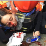 中共军警已经秘密接管了香港，至少有7万便衣潜入香港 衣服有标识 – 香港女孩被射瞎！