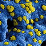 最新研究：Omicron不太喜欢侵入肺部 感染大多集中在鼻子与喉咙，从而减少重症机率